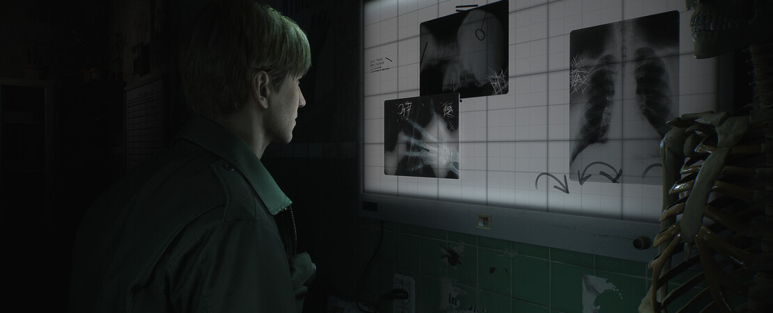 The Silent Hill 2 Remake - Everything you need to know at a glance