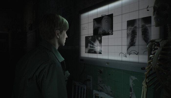 The Silent Hill 2 Remake: Everything you need to know at a glance